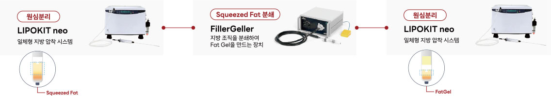 지방유래 이식재