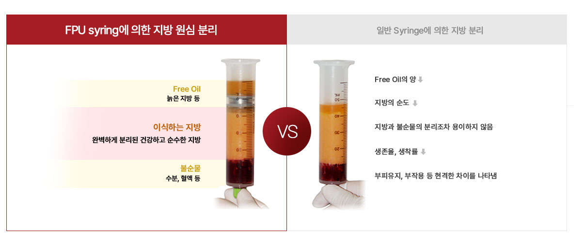 Comparison of Fat Stratification after Centrifugation